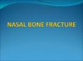 NASAL BONE FRACTURE PowerPoint PPT Presentation