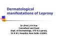Dermatological manifestations of Leprosy PowerPoint PPT Presentation