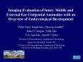 Imaging Evaluation of Inner, Middle and External Ear Congenital Anomalies with an Overview of Embryological Development PowerPoint PPT Presentation