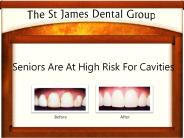 High Risk Seniors For Dental Cavities