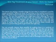 skin tag