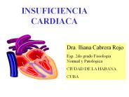 INSUFICIENCIA CARDIACA