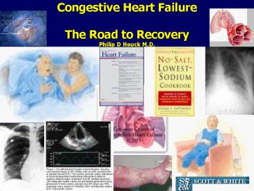 Congestive Heart Failure The Road to Recovery Philip D Houck M.D.