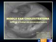 Cholesteatoma is a tumour-like mass of exfoliated keratin within a sac of stratified squamous epithelium, most often occurring in the middle ear. Cholesteatomas grow slowly, yet are able to erode and destroy bone. PowerPoint PPT Presentation