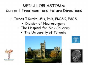 MEDULLOBLASTOMA:  Current Treatment and Future Directions