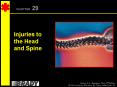 Injuries to the Head and Spine PowerPoint PPT Presentation
