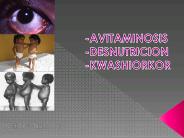 Avitaminosis