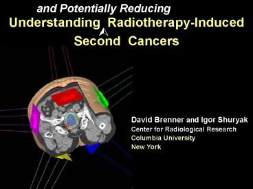 Understanding Radiotherapy-Induced Second Cancers