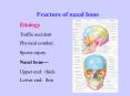 Fracture of nasal bone PowerPoint PPT Presentation