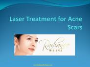 Important Facts About Acne Scars
