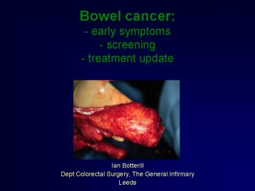 Bowel cancer: - early symptoms - screening - treatment update