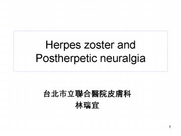 Herpes zoster and Postherpetic neuralgia