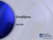 Smallpox