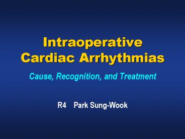 Intraoperative Cardiac Arrhythmias Cause, Recognition, and Treatment