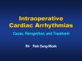 Intraoperative Cardiac Arrhythmias Cause, Recognition, and Treatment PowerPoint PPT Presentation