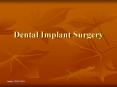 Dental Implant Surgery PowerPoint PPT Presentation