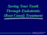 Saving Your Tooth Through Endodontic (Root Canal) Treatment