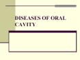 DISEASES OF ORAL CAVITY PowerPoint PPT Presentation