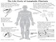 Lymphatic filariasis PowerPoint PPT Presentation