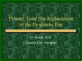 Primary Total Hip Replacement of the Dysplastic Hip PowerPoint PPT Presentation