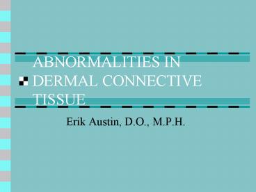 ABNORMALITIES IN DERMAL CONNECTIVE TISSUE