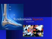 Syndesmosis Injuries