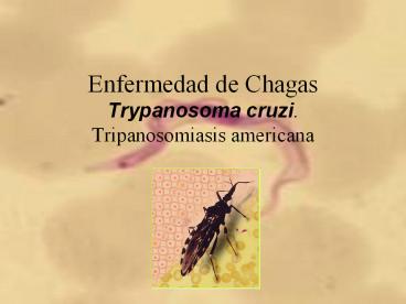 Enfermedad de Chagas Trypanosoma cruzi. Tripanosomiasis americana