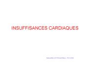 INSUFFISANCES CARDIAQUES