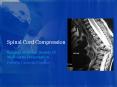Spinal Cord Compression PowerPoint PPT Presentation