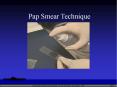 Pap Smear Technique PowerPoint PPT Presentation