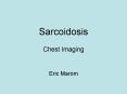 Sarcoidosis Chest Imaging PowerPoint PPT Presentation