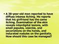 A 30-year-old man reported to have diffuse intense itching. He reports that his girlfriend has the same itching. Examination of the skin reveals interdigital lesions, with small papules, vesicles, and excoriations on the hands, and indurated nodules on PowerPoint PPT Presentation
