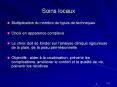 Soins locaux PowerPoint PPT Presentation