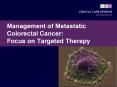 Management of Metastatic Colorectal Cancer: Focus on Targeted Therapy PowerPoint PPT Presentation