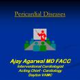 Pericardial Diseases   Ajay Agarwal MD FACC Interventional Cardiologist Acting Chief - Cardiology Dayton VAMC PowerPoint PPT Presentation