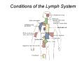 Conditions of the Lymph System PowerPoint PPT Presentation
