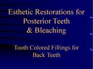 Esthetic Restorations for Posterior Teeth