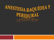 Anestesia raqu