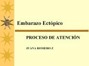 Embarazo Ect