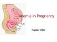 Anemia in Pregnancy PowerPoint PPT Presentation