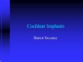 Cochlear Implants PowerPoint PPT Presentation