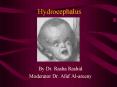 Hydrocephalus PowerPoint PPT Presentation