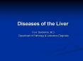 Diseases of the Liver PowerPoint PPT Presentation