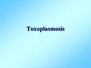 Toxoplasmosis