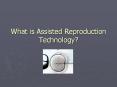 What is Assisted Reproduction Technology? PowerPoint PPT Presentation