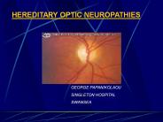 HEREDITARY OPTIC NEUROPATHIES