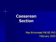 Caesarean Section