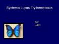 Systemic Lupus Erythematosus PowerPoint PPT Presentation