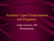 Systemic Lupus Erythematosus and Pregnancy