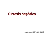 Cirrosis hep